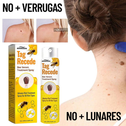 TAG RECEDE - Eliminador de Verrugas y Manchas