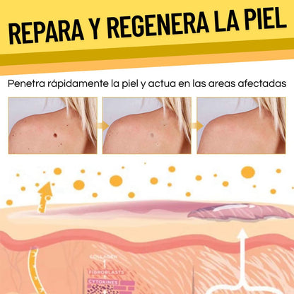 TAG RECEDE - Eliminador de Verrugas y Manchas